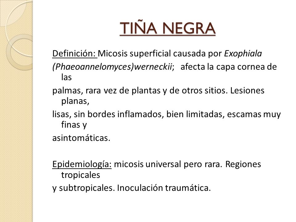 que es tiña negra